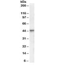 Western blot testing of human brain lysate with VDR antibody at 0.3ug/ml. Predicted molecular weight 48/54 kDa (isoforms 1/2).