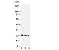 Western blot testing of BAFF antibody and Lane 1: recombinant human protein 10ng; 2: 5ng; 3: 2.5ng