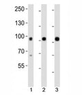 Western blot analysis of lysate from mouse 1) kidney, 2) lung and 3) skin tissue using Epha1 antibody at 1:1000.