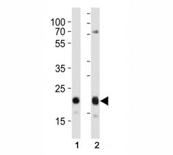 Western blot analysis of lysate from (1) HeLa and (2) MCF-7 cell line using CD9 antibody at 1:1000. Predicted molecular weight is 23-27 kDa.