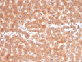 IHC staining of FFPE human liver tissue with Fibroblast Activation Protein antibody (clone FAP/4853). HIER: boil tissue sections in pH 9 10mM Tris with 1mM EDTA for 20 min and allow to cool before testing.