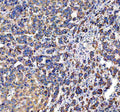 Western blot testing of DCI antibody and Lane 1: rat liver; 2: human placenta; 3: A549; 4: SMMC-7721; 5: COLO320; 6: HeLa; 7: HT1080 cell lysate. Predicted molecular weight ~33 kDa.