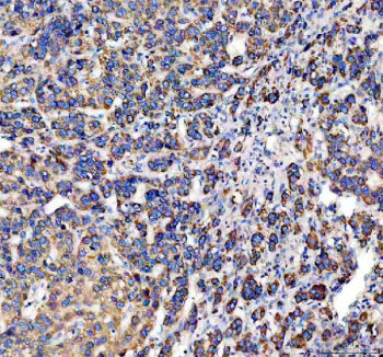 Western blot testing of DCI antibody and Lane 1: rat liver; 2: human placenta; 3: A549; 4: SMMC-7721; 5: COLO320; 6: HeLa; 7: HT1080 cell lysate. Predicted molecular weight ~33 kDa.