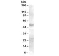 Western blot testing of human skin lysate with SMAD9 antibody at 0.3ug/ml. Predicted molecular weight: ~49 kDa.