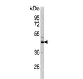 Western blot testing of human Y79 cell lysate with PSMD13 antibody. Predicted molecular weight ~43 kDa.