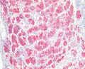 IHC testing of FFPE human adrenal gland tissue with NCAM antibody at 5ug/ml. Required HIER: steamed antigen retrieval with pH6 citrate buffer; AP-staining.