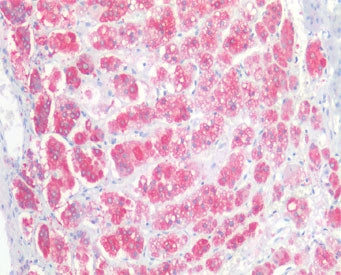 IHC testing of FFPE human adrenal gland tissue with NCAM antibody at 5ug/ml. Required HIER: steamed antigen retrieval with pH6 citrate buffer; AP-staining.