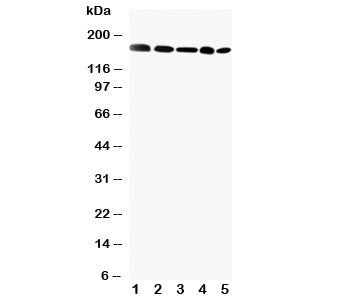 Western blot testing of GLI2 antibody and Lane 1: MCF-7; 2: HeLa; 3: SKOV; 4: HT1080; 5: A549 cell lysate. Predicted molecular weight: 86~168 kDa (multiple isoforms)(1).