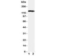 Western blot testing of COL2A1 antibody and Lane 1: rat heart; 2: rat brain tissue lysate. Predicted molecular weight ~140 kDa.