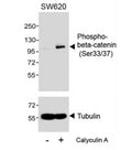 Western blot testing of extracts from SW620 cells, untreated or treated with Calyculin A, (100nM, 30min), with phospho-beta-Catenin antibody (pS33/37) at 1:1000.