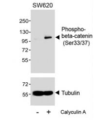 Western blot testing of extracts from SW620 cells, untreated or treated with Calyculin A, (100nM, 30min), with phospho-beta-Catenin antibody (pS33/37) at 1:1000.