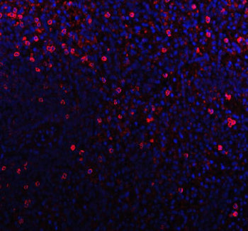 Immunofluorescent staining of FFPE human tonsil tissue with CD79b antibody (red) and DAPI nuclear stain (blue). HIER: steam section in pH8 EDTA buffer for 20 min.