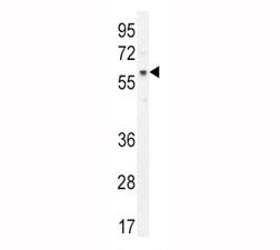 AKT antibody western blot analysis in MCF-7 lysate