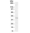 Western blot testing of human brain [frontal cortex] lysate with GNB3 antibody at 1ug/ml. Predicted molecular weight ~37kDa.