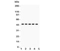 Western blot testing of PIM-1 antibody and human samples 1: U20S; 2: A549; 3: COLO320; 4: SW620; 5: Jurkat. Western blot testing of human Jurkat cell lysate with PIM1 antibody. Predicted molecular weight ~44 kDa (PIM-1L) and ~34 kDa (PIM-1S).
