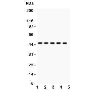 Western blot testing of PIM-1 antibody and human samples 1: U20S; 2: A549; 3: COLO320; 4: SW620; 5: Jurkat. Western blot testing of human Jurkat cell lysate with PIM1 antibody. Predicted molecular weight ~44 kDa (PIM-1L) and ~34 kDa (PIM-1S).