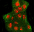 Immunofluorescent staining of SPIDR using anti-SPIDR antibody and anti-Beta Tubulin antibody. SPIDR was detected in immunocytochemical section of U2OS cell. Enzyme antigen retrieval was performed using IHC enzyme antigen retrieval reagent for 15 mins. The cells were blocked with 10% goat serum. And then incubated with 5 ug/ml rabbit anti-SPIDR antibody and mouse anti-Beta Tubulin antibody overnight at 4oC.