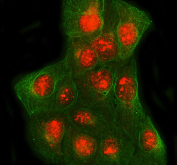 Immunofluorescent staining of SPIDR using anti-SPIDR antibody and anti-Beta Tubulin antibody. SPIDR was detected in immunocytochemical section of U2OS cell. Enzyme antigen retrieval was performed using IHC enzyme antigen retrieval reagent for 15 mins. The cells were blocked with 10% goat serum. And then incubated with 5 ug/ml rabbit anti-SPIDR antibody and mouse anti-Beta Tubulin antibody overnight at 4oC.