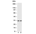 Western blot testing of Kallikrein-1 antibody and Lane 1: rat pancreas lysate; 2: rat kidney lysate. Predicted molecular weight ~29 kDa.