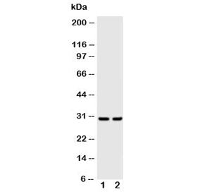 Western blot testing of Kallikrein-1 antibody and Lane 1: rat pancreas lysate; 2: rat kidney lysate. Predicted molecular weight ~29 kDa.