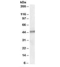 Western blot testing of human testis lysate with STK35 antibody at 1ug/ml. Predicted molecular weight: ~45kDa.