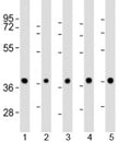 Western blot testing of 1) mouse BA/F3 cell lysate and human 2) HeLa, 3) K562, 4) MCF-7 and 5) Raji cell lysate with PPP2R4 antibody at 1:2000. Expected molecular weight: 37/41/33/32 kDa (alpha/beta/delta/epsilon isoforms).