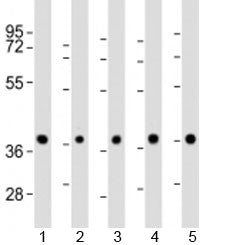 Western blot testing of 1) mouse BA/F3 cell lysate and human 2) HeLa, 3) K562, 4) MCF-7 and 5) Raji cell lysate with PPP2R4 antibody at 1:2000. Expected molecular weight: 37/41/33/32 kDa (alpha/beta/delta/epsilon isoforms).