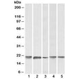 Western blot testing of human 1) cerebellum, 2) liver, 3) placenta, 4) mouse brain and 5) rat brain lysate with FTL antibody at 0.1ug/ml. Predicted molecular weight: ~20 kDa.