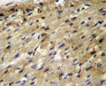ABCD2 antibody immunohistochemistry analysis in formalin fixed and paraffin embedded human heart tissue.