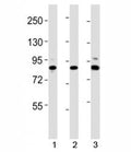 Western blot testing of Suz12 antibody at 1:2000 dilution. Lane 1: mouse spleen lysate; 2: mouse cerebellum lysate; 3: human HeLa lysate; Observed molecular weight 83~95 kDa.