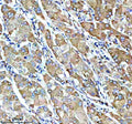 IHC analysis of SUCO using anti-SUCO antibody. SUCO was detected in a paraffin-embedded section of human pancreas cancer tissue. Heat mediated antigen retrieval was performed in EDTA buffer (pH 8.0, epitope retrieval solution). The tissue section was blocked with 10% goat serum. The tissue section was then incubated with 2 ug/ml rabbit anti-SUCO antibody overnight at 4oC. Peroxidase Conjugated Goat Anti-rabbit IgG was used as secondary antibody and incubated for 30 min at 37oC.