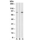 Western blot testing of HEK293 lysate overexpressing human STAT4-MYC probed with STAT4 antibody (0.5ug/ml) in Lane A and anti-MYC (1/1000) in lane C. Mock-transfected HEK293 probed with STAT4 (1ug/ml) in Lane B. Predicted molecular weight: ~86kDa.