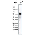 Western blot testing of human HeLa cell lysate with recombinant CD44 antibody (clone rHCAM/918). Predicted molecular weight ~81 kDa.