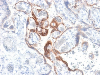 IHC testing of FFPE human placenta with HCG-beta antibody (clone HCGb/1985R). Required HIER: boil tissue sections in 10mM citrate buffer, pH 6, for 10-20 min followed by cooling at RT for 20 min.