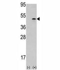 Western blot analysis of Aurora B antibody and 293 cell lysate (2 ug/lane) either nontransfected (Lane 1) or transiently transfected with the AURKB gene (2).