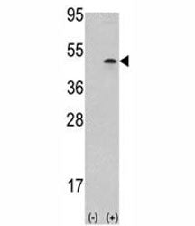 Western blot analysis of Aurora B antibody and 293 cell lysate (2 ug/lane) either nontransfected (Lane 1) or transiently transfected with the AURKB gene (2).