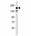 Western blot testing of ERBB4 antibody at 1:500 dilution + rat brain lysate; Predicted molecular weight: 147-180 kDa (precursor), 120, 80 kDa (cleaved forms).
