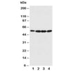 Western blot testing of Fascin antibody and Lane 1: U87; 2: A549; 3: MCF-7; 4: HT1080 cell lysate. Predicted molecular weight ~55kDa.
