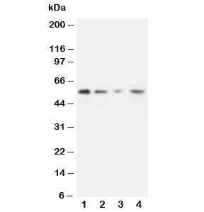 Western blot testing of MMP10 antibody and Lane 1: recombinant human protein 10ng; 2: 5ng; 3: 2.5ng; 4: HeLa lysate.