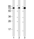 Western blot testing of human 1) Jurkat, 2) Ramos and 3) HT-1080 cell lysate with GARS antibody at 1:2000. Predicted molecular weight: 83 kDa.
