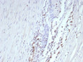 IHC staining of FFPE human prostate tissue with recombinant Transcriptional Regulator ERG antibody (clone ERG/9122R) at 2ug/ml. HIER: boil tissue sections in pH 9 10mM Tris with 1mM EDTA for 20 min and allow to cool before testing.