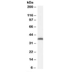 Western blot testing of NIH3T3 cell lysate with ARA9 antibody at 0.02ug/ml. Predicted molecular weight: ~37 kDa.