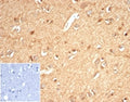 IHC staining of FFPE human brain tissue with recombinant Aldose reductase antibody (clone AKR1B1/7010R) at 2ug/ml in PBS for 30 min RT. Negative control inset: PBS used instead of primary antibody to control for secondary Ab binding. HIER: boil tissue sections in pH 9 10mM Tris with 1mM EDTA for 20 min and allow to cool before testing.