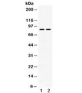 Western blot testing of 1) human HeLa and 2) mouse NIH3T3 cell lysate with Phospholipase A2 antibody. Expected/observed molecular weight ~85 kDa.