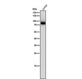 Western blot testing of human Jurkat cell lysate using the Pan-PKC antibody at 1:5000 dilution for 1 hour at room temperature.