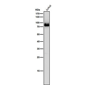 Western blot testing of human Jurkat cell lysate using the Pan-PKC antibody at 1:5000 dilution for 1 hour at room temperature.