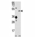 Western blot analysis of SIRT7 antibody and 293 cell lysate (2 ug/lane) either nontransfected (Lane 1) or transiently transfected with the SIRT7 gene (2).
