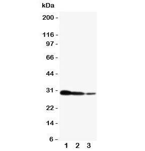 Western blot testing of CRTC2 antibody and human recombinant protein, 29KD with tag; Lane 1:10ng; 2: 5ng; 3: 2.5ng