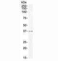 Western blot testing of human kidney lysate with Sprouty antibody at 0.3ug/ml. Predicted molecular weight ~35 kDa.