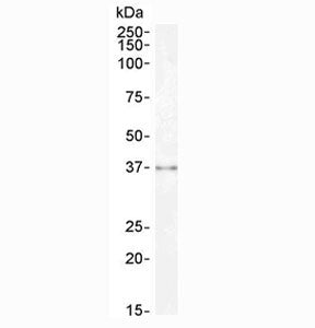 Western blot testing of human kidney lysate with Sprouty antibody at 0.3ug/ml. Predicted molecular weight ~35 kDa.